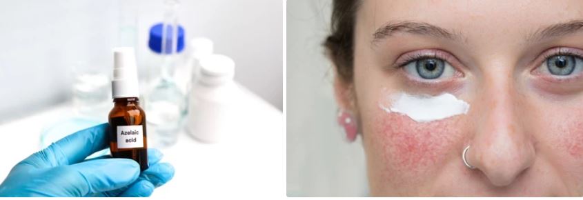 Azelaic Acid Serum Manufacturer
